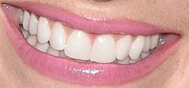 Picture of Cameran Eubanks teeth and smile