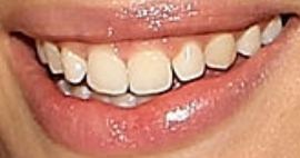 Picture of Cameron Russell teeth and smile