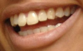Picture of Camila Alves McConaughey teeth and smile