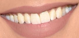 Picture of Camila Banus teeth and smile