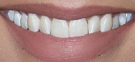 Picture of Camila Banus teeth and smile