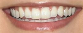 Picture of Camila Mendes teeth and smile