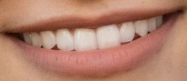 Picture of Camila Mendes teeth and smile