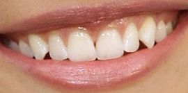Picture of Camilla Belle teeth and smile