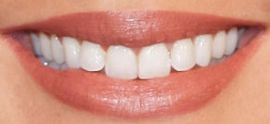 Picture of Camilla Luddington teeth and smile