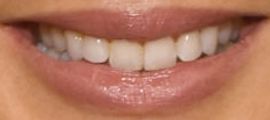 Picture of Camilla Luddington teeth and smile