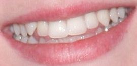 Picture of Camryn Grimes teeth and smile