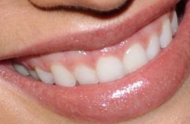 Picture of Candice Swanepoel teeth and smile