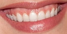 Picture of Candice Swanepoel teeth and smile