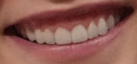 Picture of Cara Delevingne teeth and smile