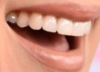 Carrie Underwood teeth