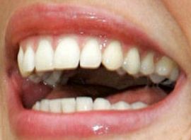 Picture of Cat Deeley teeth and smile