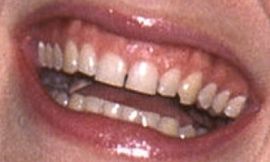 Picture of Cate Blanchett teeth