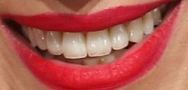 Picture of Catherine Siachoque teeth and smile