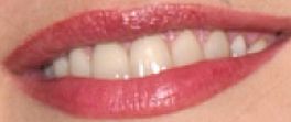 Picture of Catherine Zeta-Jones teeth and smile