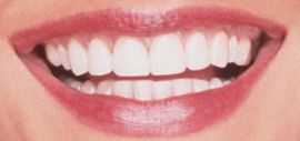 Picture of Catherine Zeta-Jones teeth and smile