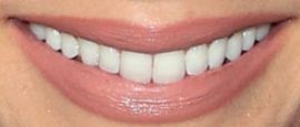 Picture of Cerina Vincent teeth and smile