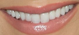 Picture of Cerina Vincent teeth and smile