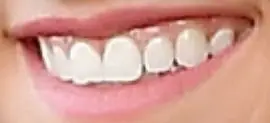 Picture of Charli D'Amelio teeth and smile