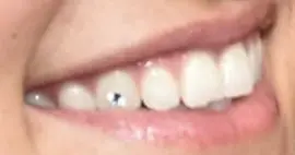 Picture of Charli D'Amelio teeth and smile