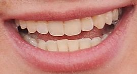 Picture of Charlie Puth teeth and smile