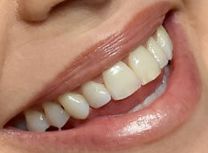 Charlize Theron teeth