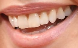 Charlize Theron teeth