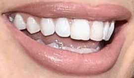 Picture of Charlotte McKinney teeth and smile