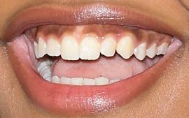 Picture of China Anne McClain teeth and smile
