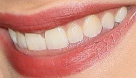 Picture of Chloe Grace Moretz teeth and smile