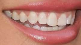 Picture of Chrishell Stause teeth and smile