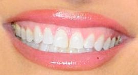 Picture of Chrishell Stause teeth and smile