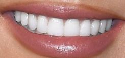 Picture of Chrissy Teigen teeth and smile
