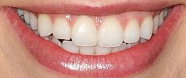 Picture of Christa B. Allen teeth and smile