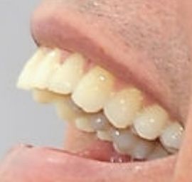 Picture of Christian LeBlanc teeth and smile