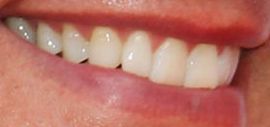 Picture of Christian LeBlanc teeth and smile