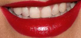 Picture of Christina Aguilera teeth and smile