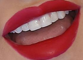Picture of Christina Aguilera teeth and smile