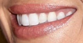 Picture of Christina Anstead teeth and smile