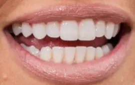 Picture of Christina Anstead teeth and smile