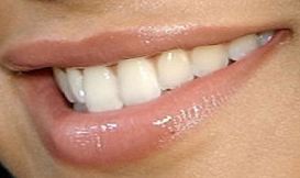 Picture of Christina Milian teeth and smile