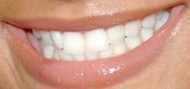 Picture of Christina Milian teeth and smile