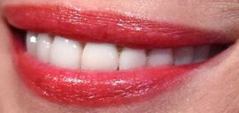 Picture of Christy Turlington teeth and smile