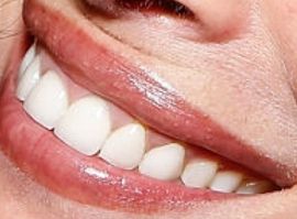 Picture of Christy Turlington teeth and smile