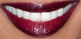 Picture of Ciara teeth and smile