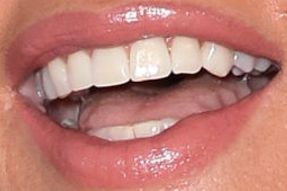 Picture of Cindy Crawford teeth and smile