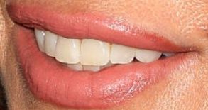 Picture of Cindy Crawford teeth and smile