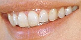 Picture of Claudia Schiffer teeth and smile