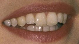 Picture of Claudia Schiffer teeth and smile