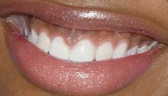 Picture of Coco Jones teeth and smile